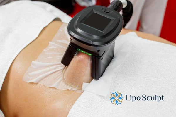 Does Fat Freezing at Home Work? DIY Devices vs Professional Cryolipolysis 1 How is professional cryolipolysis different Ashton on Ribble?